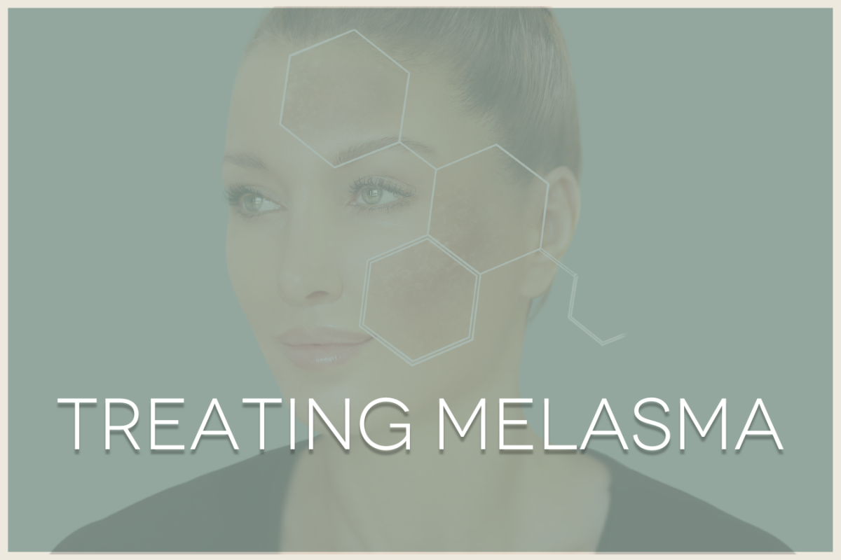 Treating melasma (model face with dark pigmentation)