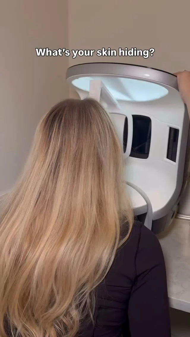 Not all skin concerns are visible at the surface.
That’s why we begin with a VISIA Skin Analysis — a clinical-grade imaging system that evaluates your skin in eight key areas: sun damage, fine lines, pore size, texture, bacteria, redness, and more.
This data allows us to create a personalized treatment plan that’s both results-driven and aligned with your long-term skin goals.
If you’re serious about improving your skin, this is where it starts!