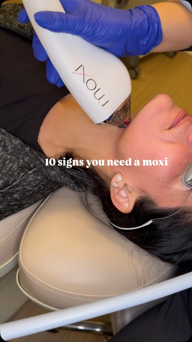 MOXI laser is a popular non-invasive treatment designed to refresh and rejuvenate your skin with minimal downtime. It’s ideal for improving early signs of aging, sun damage, uneven tone, and texture.

Why clients love MOXI:
• Brightens and evens skin tone
• Smooths texture and boosts collagen
• Maintains skin health
• Safe for all skin types and tones
• Minimal downtime, long-lasting results

Whether you’re focused on prevention or targeting specific concerns like pigmentation or fine lines, MOXI is a smart, year-round skincare solution.

Provider: Alyssa

Comment or DM us “MOXI” to learn more about this treatment!