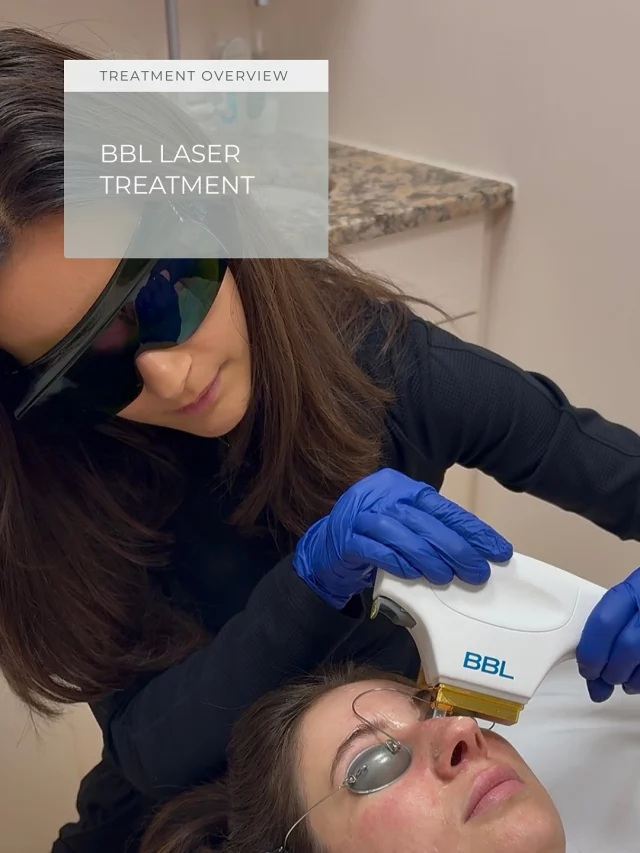 Brighter skin starts with BBL.

Swipe to see how this next-gen light therapy fades sun damage, reduces redness, targets acne, and boosts your glow with virtually no downtime.

Our trained providers at Q the Medical Spa use Sciton’s BBL technology to deliver gentle, effective treatments that refresh your skin in about 30 minutes.

Want details? Comment or DM us “BBL” to set up a consult, see before & afters, and get pricing.