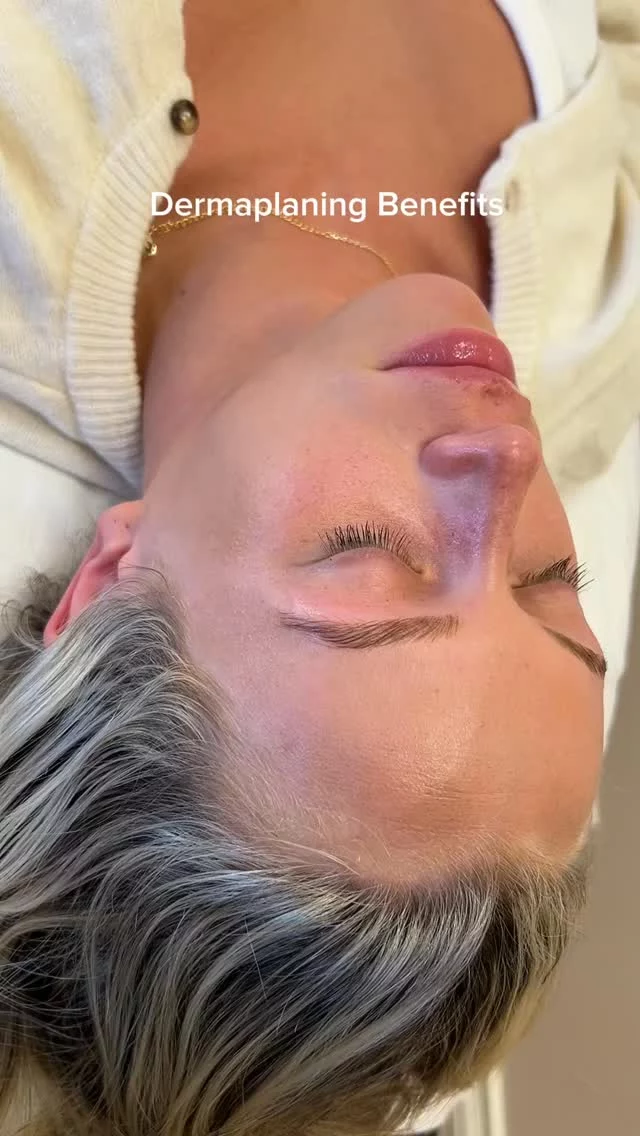 Bridal glow without the downtime.

This bride-to-be wanted smoother makeup + radiant skin before her big day - without the risk of peeling.

We did:
• Dermaplaning
• Enzyme treatment
• LED therapy

She’s also been prepping for months with peels + Hydrafacials and it shows.

Want wedding-ready skin? Start early, stay consistent.

Esthetician: Adrijana