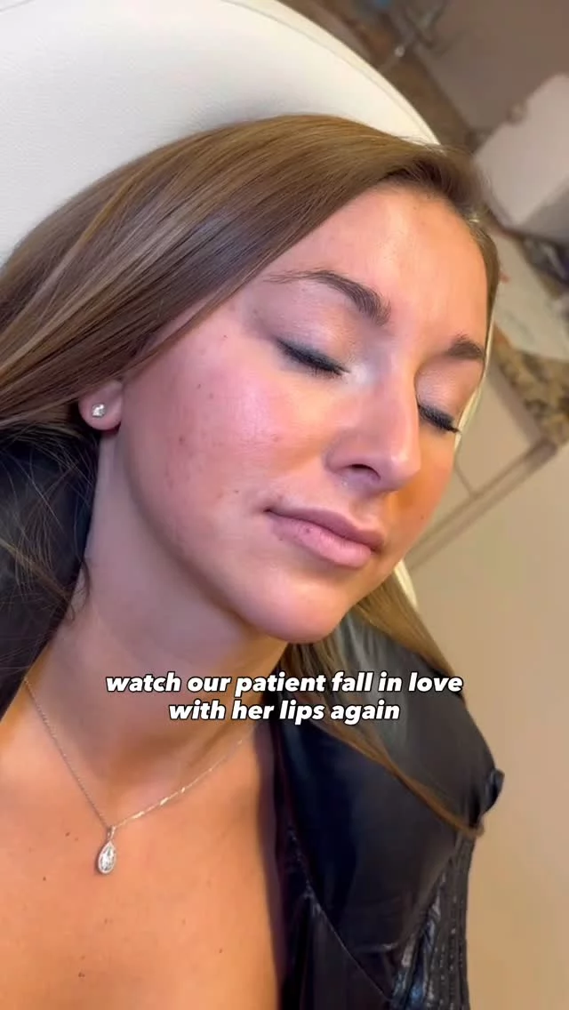 Sometimes all it takes is a little refresh 💉

This patient had a subtle lip filler touch-up by Stacy for soft, plump lips she’s loving!

Comment “LIPS” to schedule your appointment today🤍